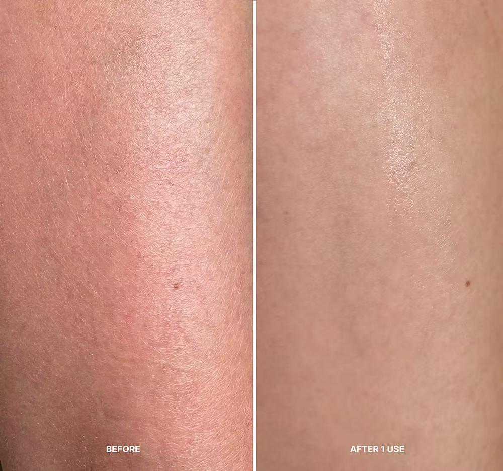 Korean Body Resurfacing™ Instant Peel