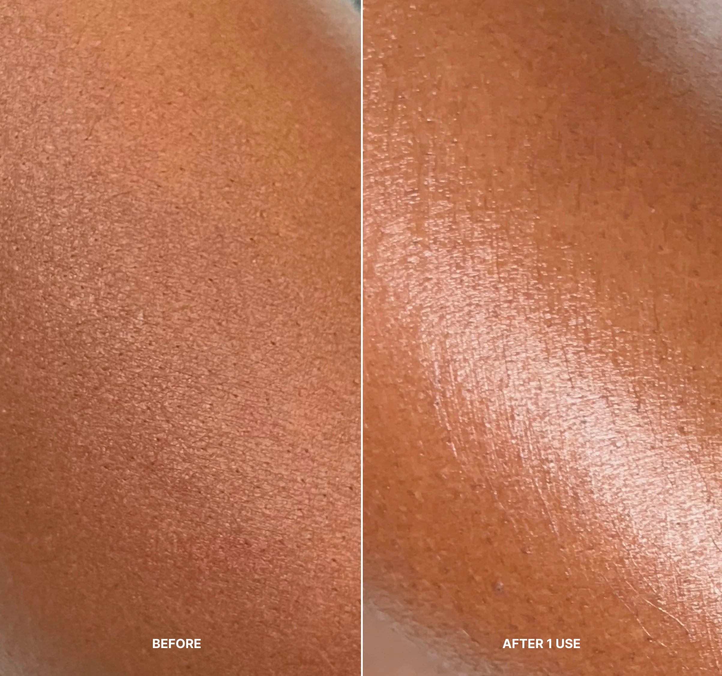 Korean Body Resurfacing™ Firming Serum